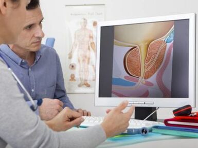 Bir ürolog, hastaya prostatit ve tedavi yöntemleri hakkında danışır.